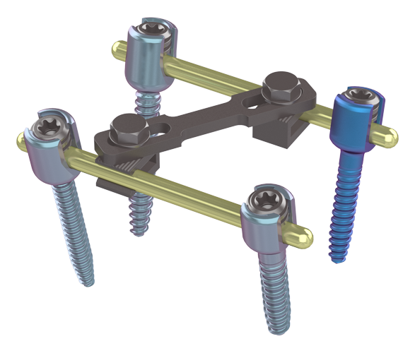 Sistema Massa Lateral